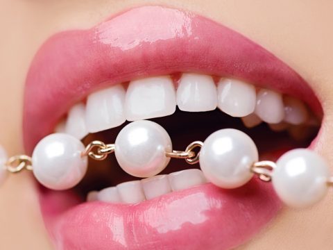 Bọc răng sứ thẩm mỹ có được lâu không?