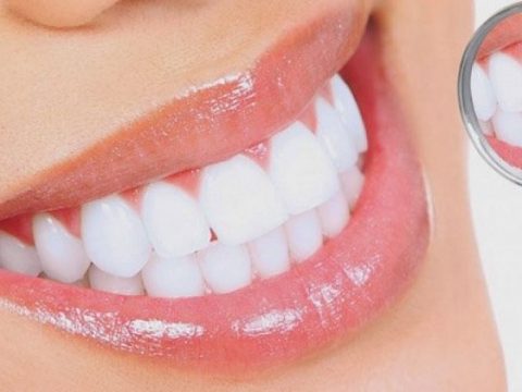 Có nên làm răng sứ thẩm mỹ?