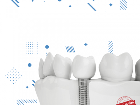 Dính thức ăn bên dưới răng sau cấy Implant có sao không?