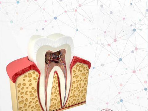 Răng đã lấy tủy có nên bọc răng sứ?