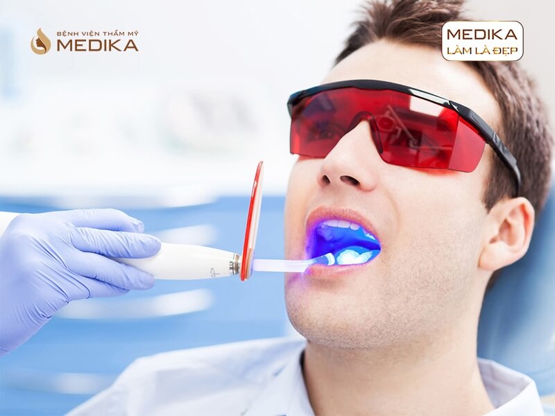 Tẩy trắng răng bằng Laser cho răng bị loang màu có được không? Tại nha khoa MEDIKA