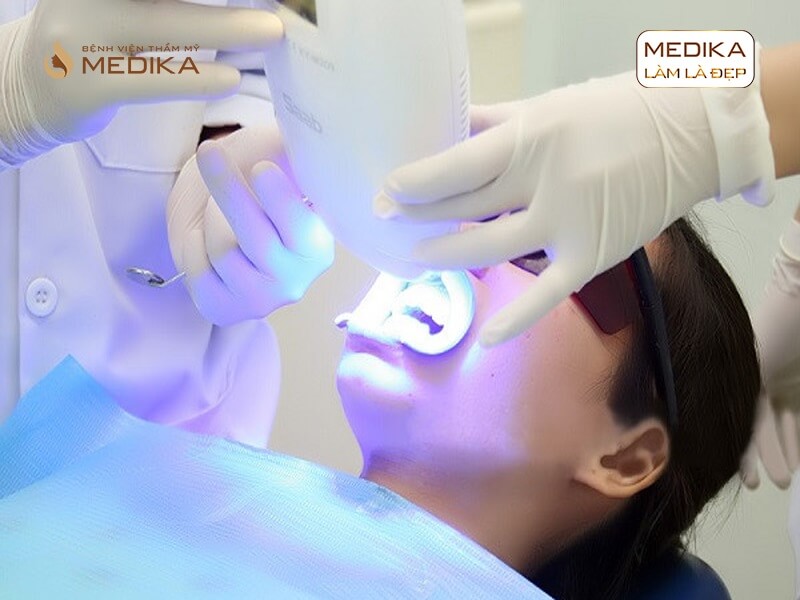 Tìm hiểu về phương pháp tẩy trắng răng bằng Laser nha khoa MEDIKA